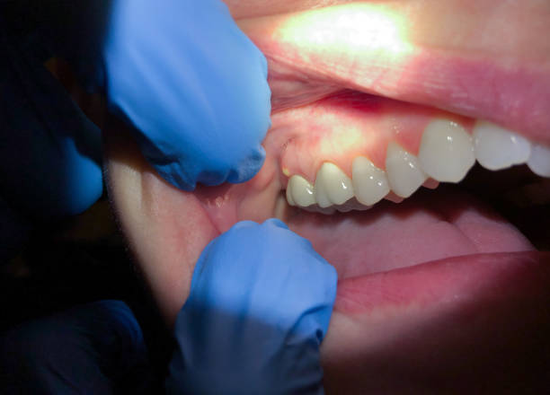 Best Emergency Cosmetic Dentistry (e.g., broken veneers) in Pflugerville, TX