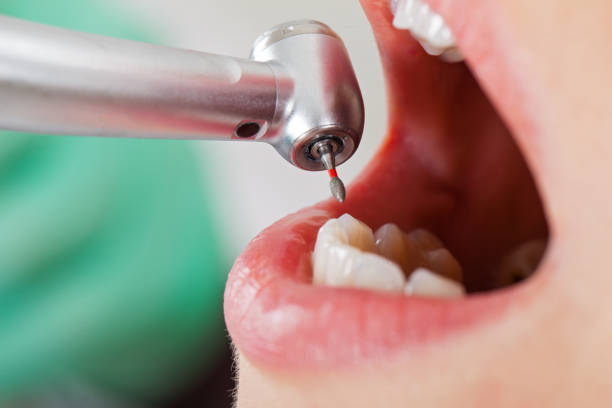 Best Emergency Root Canal Therapy in Pflugerville, TX